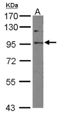 Western Blot: EFTUD2 Antibody [NBP2-16282]