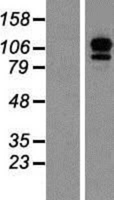 Western Blot: EFTUD2 Overexpression Lysate [NBP2-07895]