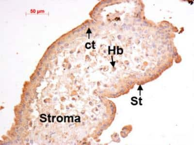 Immunohistochemistry: EG-VEGF/PK1 Antibody [NBP2-43852]