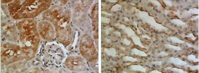 Immunohistochemistry-Paraffin: EGF Antibody (RM0078-2M13) - Azide and BSA Free [NBP1-21708]