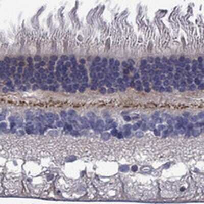 Immunohistochemistry-Paraffin: EGFLAM Antibody [NBP3-17359]