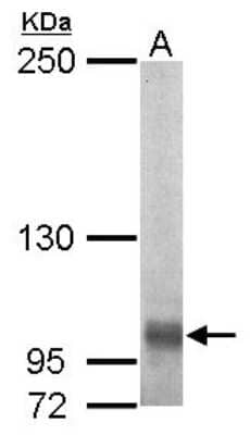 Western Blot: EGFLAM Antibody [NBP2-14941]