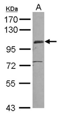 Western Blot: EGFLAM Antibody [NBP2-14941]