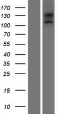 Western Blot: EGFLAM Overexpression Lysate [NBP2-05379]