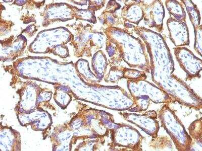 Immunohistochemistry-Paraffin: EGFR Antibody (31G7 + GFR1195) - IHC-Prediluted [NBP2-48218]