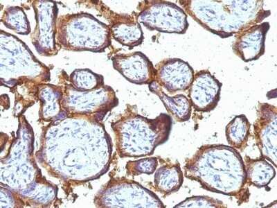 Immunohistochemistry-Paraffin: EGFR Antibody (31G7) - Azide and BSA Free [NBP2-47740]