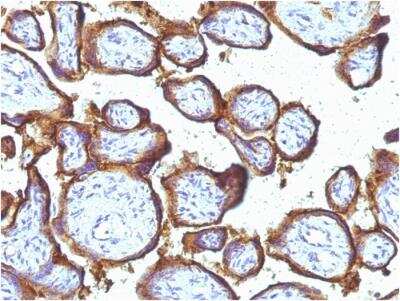 Immunohistochemistry-Paraffin: EGFR Antibody (31G7) - IHC-Prediluted [NBP2-48202]