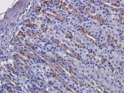 Immunohistochemistry: EGFR Antibody (C225 (Cetuximab)) - Chimeric - Azide and BSA Free [NBP2-52671]