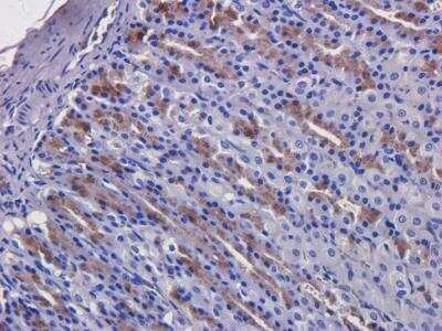 Immunohistochemistry: EGFR Antibody (C225 (Cetuximab)) - Azide and BSA Free [NBP2-75903]