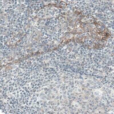 Immunohistochemistry-Paraffin: EGFR Antibody (CL0815) [NBP2-52952]