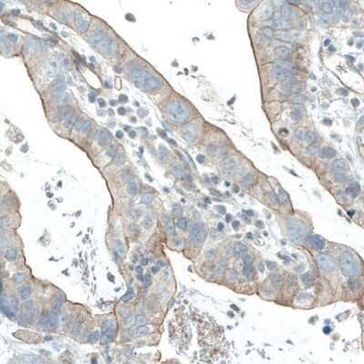 Immunohistochemistry-Paraffin: EGFR Antibody (CL0815) [NBP2-52952]