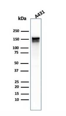 Western Blot: EGFR Antibody (GFR/1667)Azide and BSA Free [NBP2-54310]