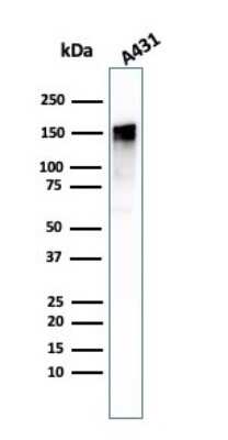 Western Blot: EGFR Antibody (GFR/1708)Azide and BSA Free [NBP2-54330]