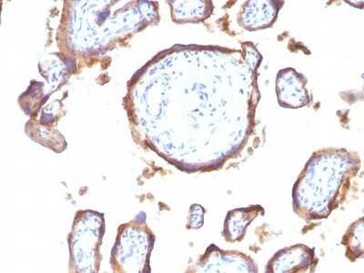 Immunohistochemistry-Paraffin: EGFR Antibody (GFR1195) - Azide and BSA Free [NBP2-47742]