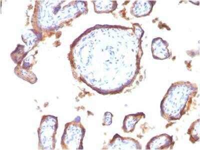 Immunohistochemistry-Paraffin: EGFR Antibody (GFR1195) - IHC-Prediluted [NBP2-48217]