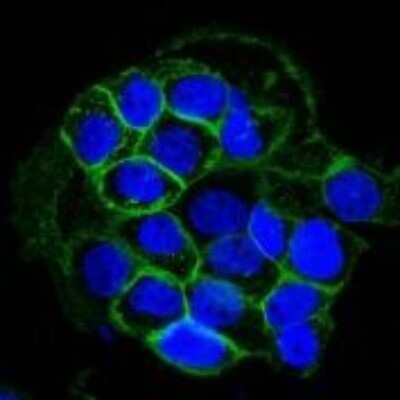 Immunocytochemistry/ Immunofluorescence: EGFR Antibody (GFR450) - Azide and BSA Free [NBP2-33068]