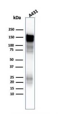 Western Blot: EGFR Antibody (H9B4) [NBP2-34243]