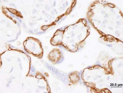 Immunohistochemistry-Paraffin: EGFR Antibody [NB100-596]