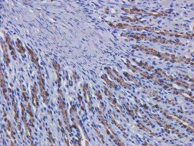 Immunohistochemistry: EGFR Antibody (Matuzumab) - Azide and BSA Free [NBP2-75911]