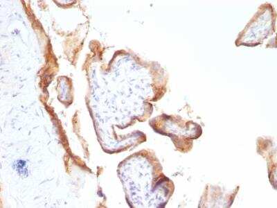 Immunohistochemistry-Paraffin: EGFR Antibody (SPM622) - IHC-Prediluted [NBP2-48203]