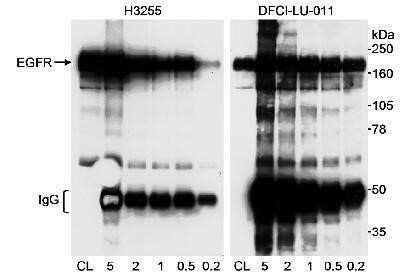 Western Blot: EGFR Antibody [NB100-596]