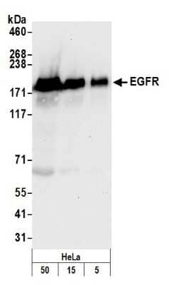 Western Blot: EGFR Antibody [NB100-596]