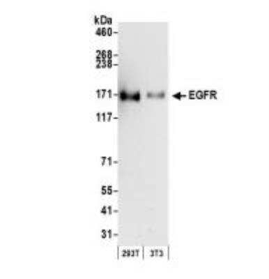 Western Blot: EGFR Antibody [NB100-596]