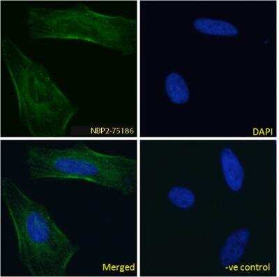 Immunofluorescence: EGFR Antibody (h-R3 (Nimotuzumab)) - Azide and BSA Free [NBP2-75186]