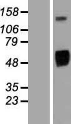 Western Blot: EGFR Overexpression Lysate [NBP2-04608]