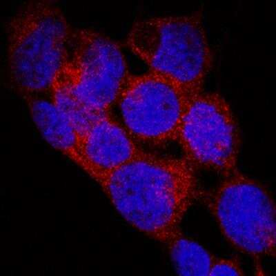 Immunocytochemistry/ Immunofluorescence: EGLN1/PHD2 Antibody (2445B) - BSA Free [NBP2-76810]