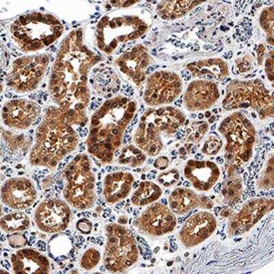 Immunohistochemistry-Paraffin: EGLN1/PHD2 Antibody (2445B) - BSA Free [NBP2-76810]