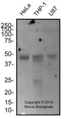 Western Blot: EGLN1/PHD2 Antibody (2445B)BSA Free [NBP2-76810]