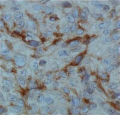 Immunohistochemistry: EGLN1/PHD2 Antibody (366G/76/3) - Azide and BSA Free [NBP2-80712]