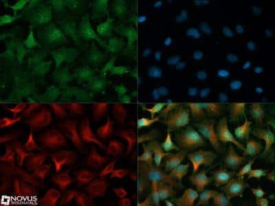 Immunocytochemistry/ Immunofluorescence: EGLN1/PHD2 Antibody - BSA Free [NB100-2219]