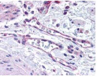 Immunohistochemistry: EGLN1/PHD2 Antibody [NB100-137]