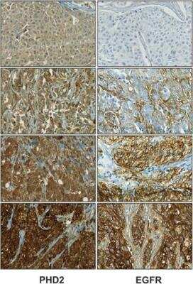 Immunohistochemistry: EGLN1/PHD2 Antibody [NB100-137]