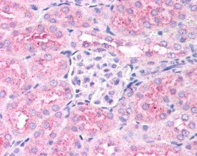 Immunohistochemistry: EGLN1/PHD2 Antibody - BSA Free [NB100-2219]