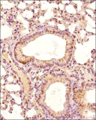 Immunohistochemistry-Paraffin: EGLN1/PHD2 Antibody - BSA Free [NB100-2219]
