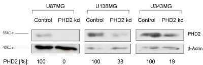 Knockdown Validated: EGLN1/PHD2 Antibody [NB100-137]