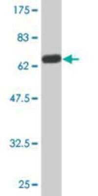 Western Blot: EGLN2/PHD1 Antibody (2G3) [H00112398-M01]