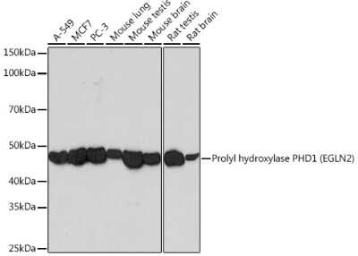 Western Blot: EGLN2/PHD1 Antibody (2G9M7) [NBP3-16265]