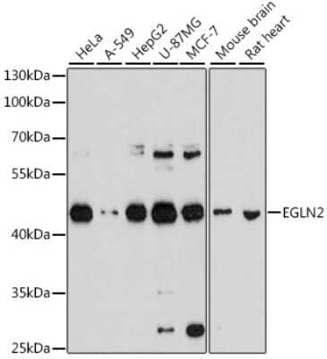 Western Blot: EGLN2/PHD1 AntibodyBSA Free [NBP2-92974]