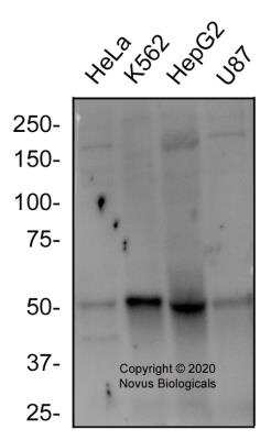 Western Blot: EGLN2/PHD1 AntibodyBSA Free [NBP3-05472]