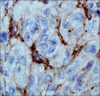 Immunohistochemistry: EGLN3/PHD3 Antibody (EG188e/d5) - BSA Free [NBP1-30440]