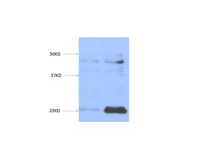 Western Blot: EGLN3/PHD3 Antibody (EG188e/d5)BSA Free [NBP1-30440]