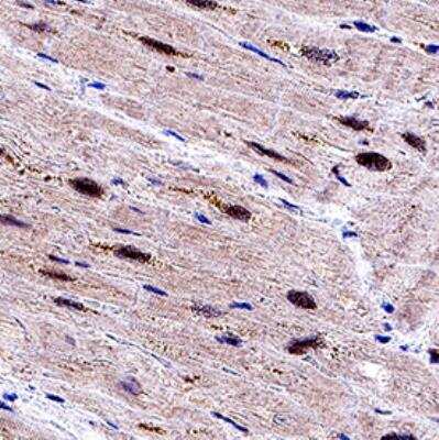 Immunohistochemistry: EGLN3/PHD3 Antibody - BSA Free [NB100-303]