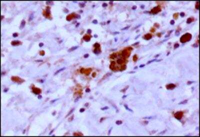 Immunohistochemistry-Paraffin: EGLN3/PHD3 Antibody - BSA Free [NB100-139]