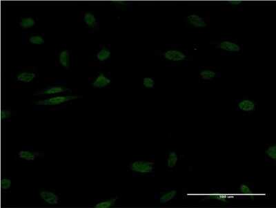 Immunocytochemistry/ Immunofluorescence: EGR1 Antibody (1F5) [H00001958-M08]