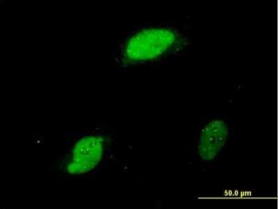 Immunocytochemistry/ Immunofluorescence: EGR1 Antibody (6E8) [H00001958-M03]
