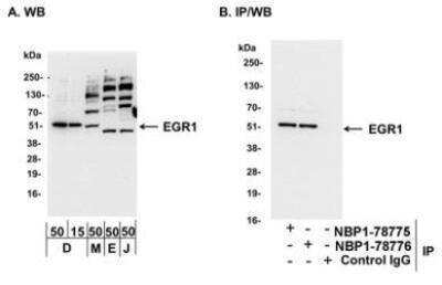 Western Blot: EGR1 Antibody [NBP1-78775]